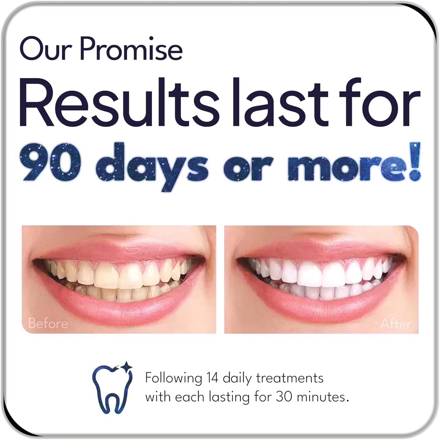 Before and after teeth whitening comparison using nanoWHITE 3-in-1 Whitening Pen